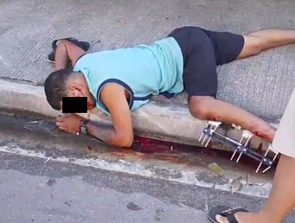 Equipe médica atendendo vítimas de acidente de moto grave em hospital público