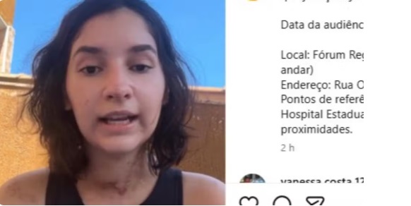 Alana Anísio após tentativa de feminicídio em São Gonçalo