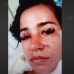 Jovem é esfaqueada dezenas de vezes na Praça Seca; ex-sogra é apontada como suspeita